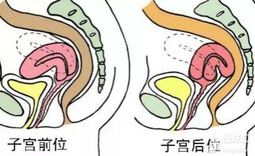 子宮后位很難懷孕嗎？醫(yī)生：掌握這兩點輕松受孕