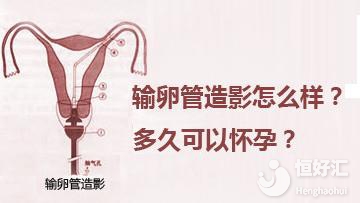 輸卵管造影很疼嗎？危害大不大？醫生這樣說……