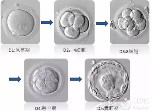  試管嬰兒胚胎等級如何劃分？花三分鐘看懂