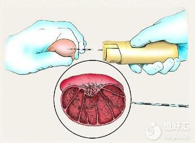 試管嬰兒對精子有要求嗎？醫(yī)生：這幾點很常見