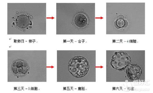 想養囊胚提高受孕率？首先要看自己合不合格