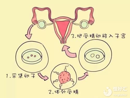 試管嬰兒“回家”過程你都知道嗎？真相在這里