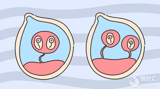 試管嬰兒可以一次生雙胞胎嗎？專家這樣說……