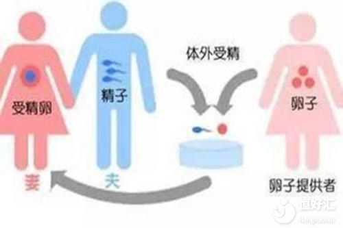 供卵試管很難一次成功？這4個(gè)因素很重要