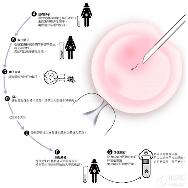 廣州做試管嬰兒過程中，為什么有的人一個卵子都取不到？取卵老是失??？