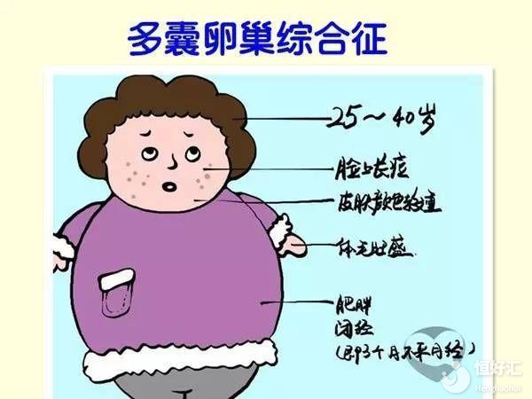 治療多囊卵巢綜合征的方法有三種，呵護(hù)女性健康，需盡早了解