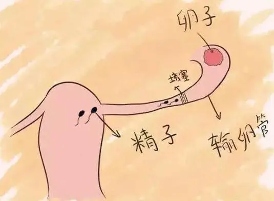 輸卵管堵塞，中醫(yī)的辨證分型有哪些？